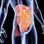 Leaky Gut: Is it Becoming an Epidemic?
