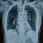 Inhaled Microplastics Impair Lung Immunity and Spread to Organs